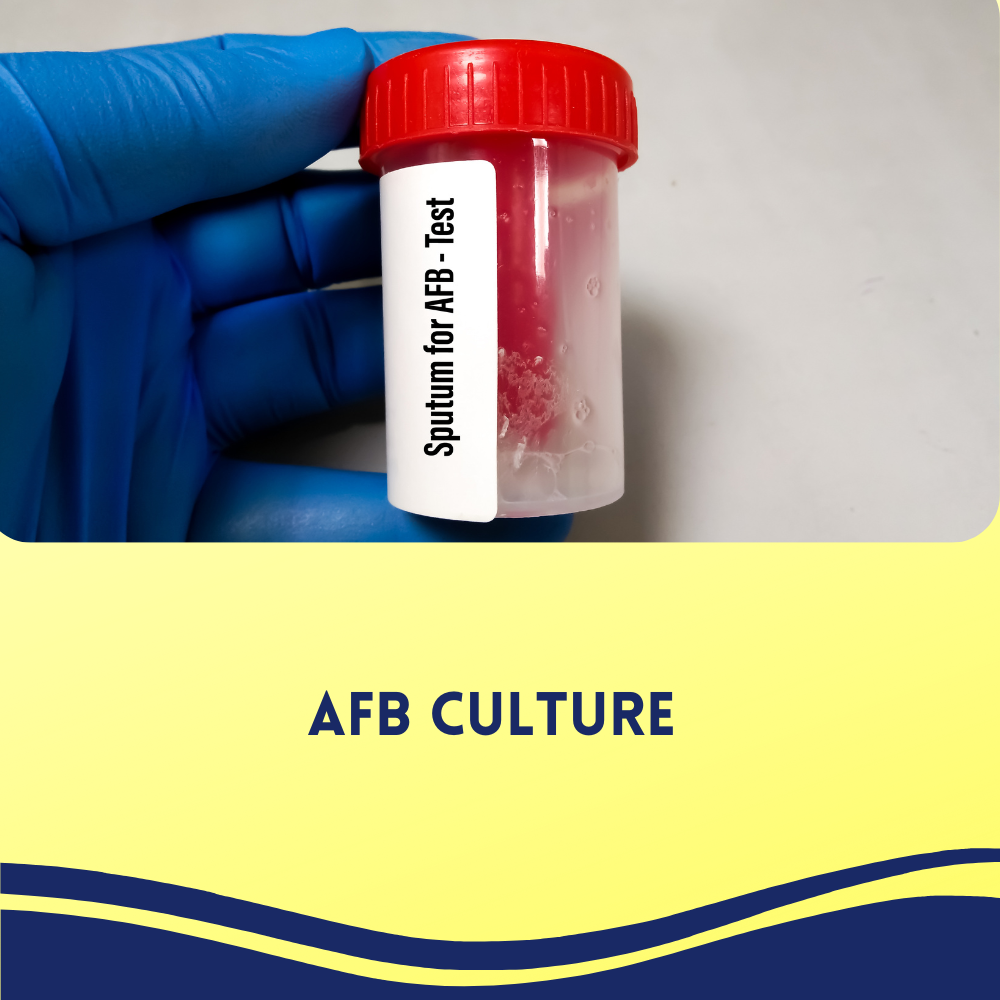 AFB Culture