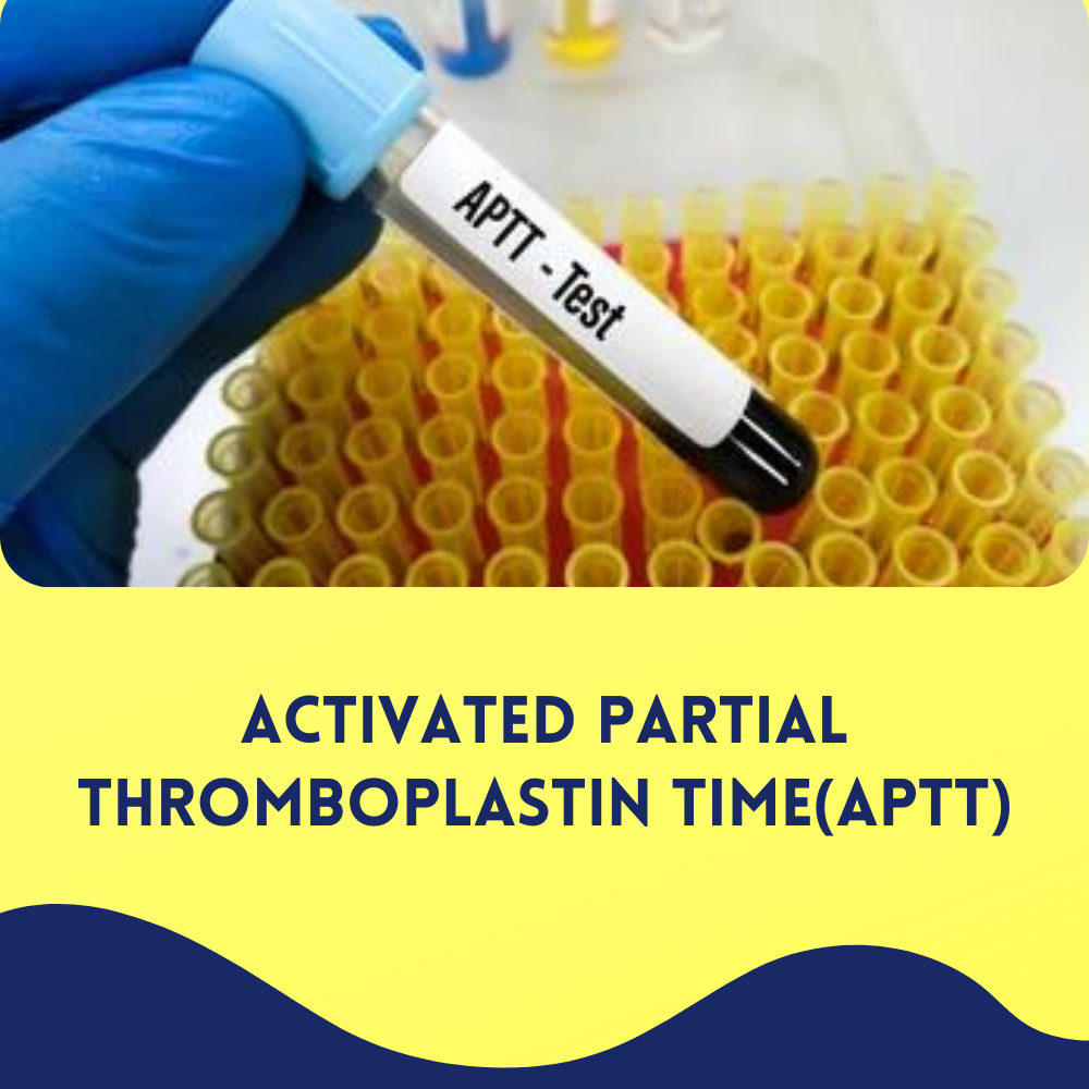 Activated Partial Thromboplastin Time(APTT)