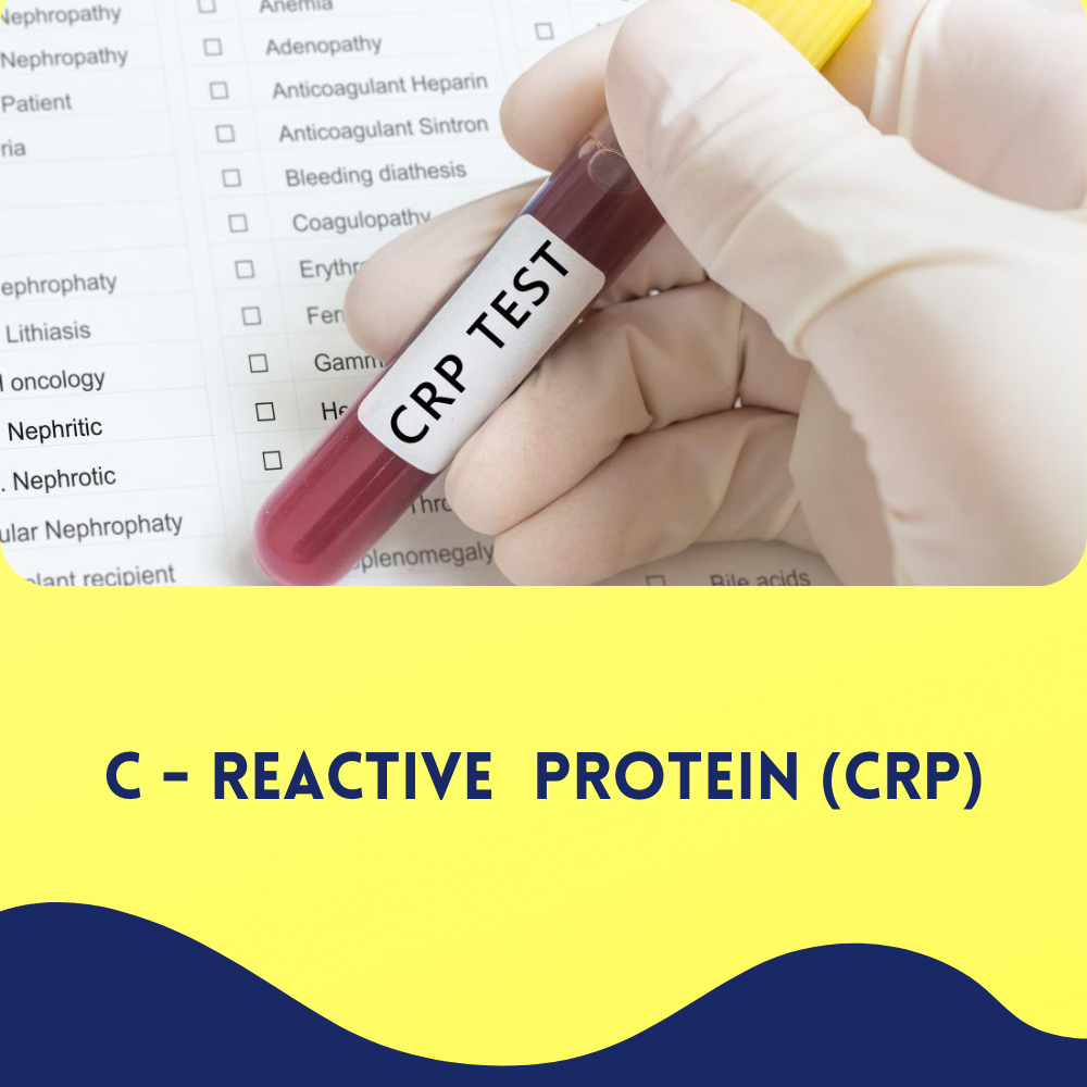C - reactive Protein (CRP)