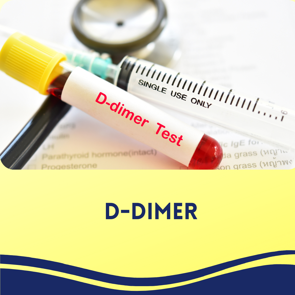 D-DIMER