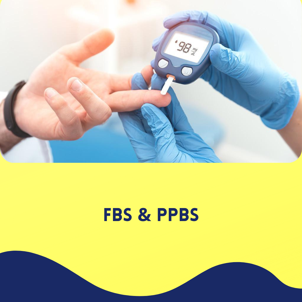 FBS & PPBS
