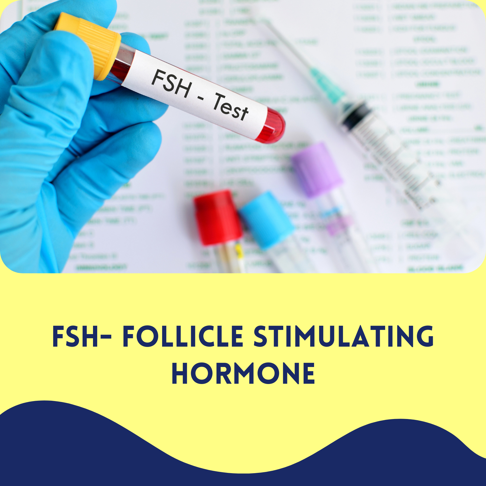 FSH- Follicle stimulating hormone