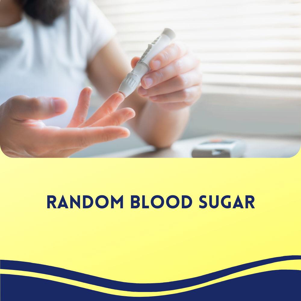 Random Blood Sugar
