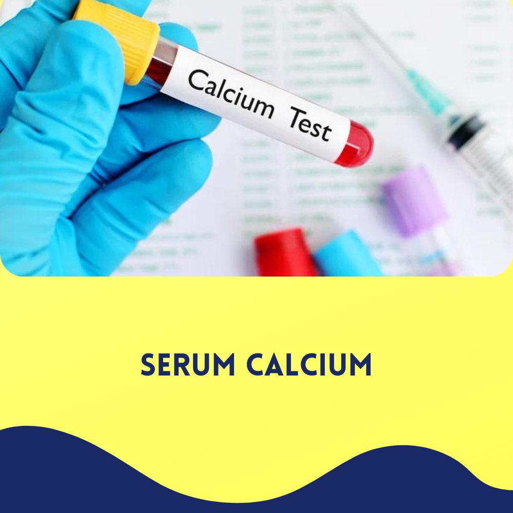 Serum Calcium