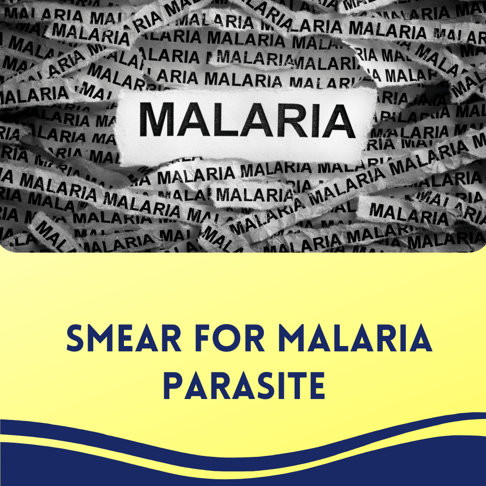 Smear For Malaria Parasite