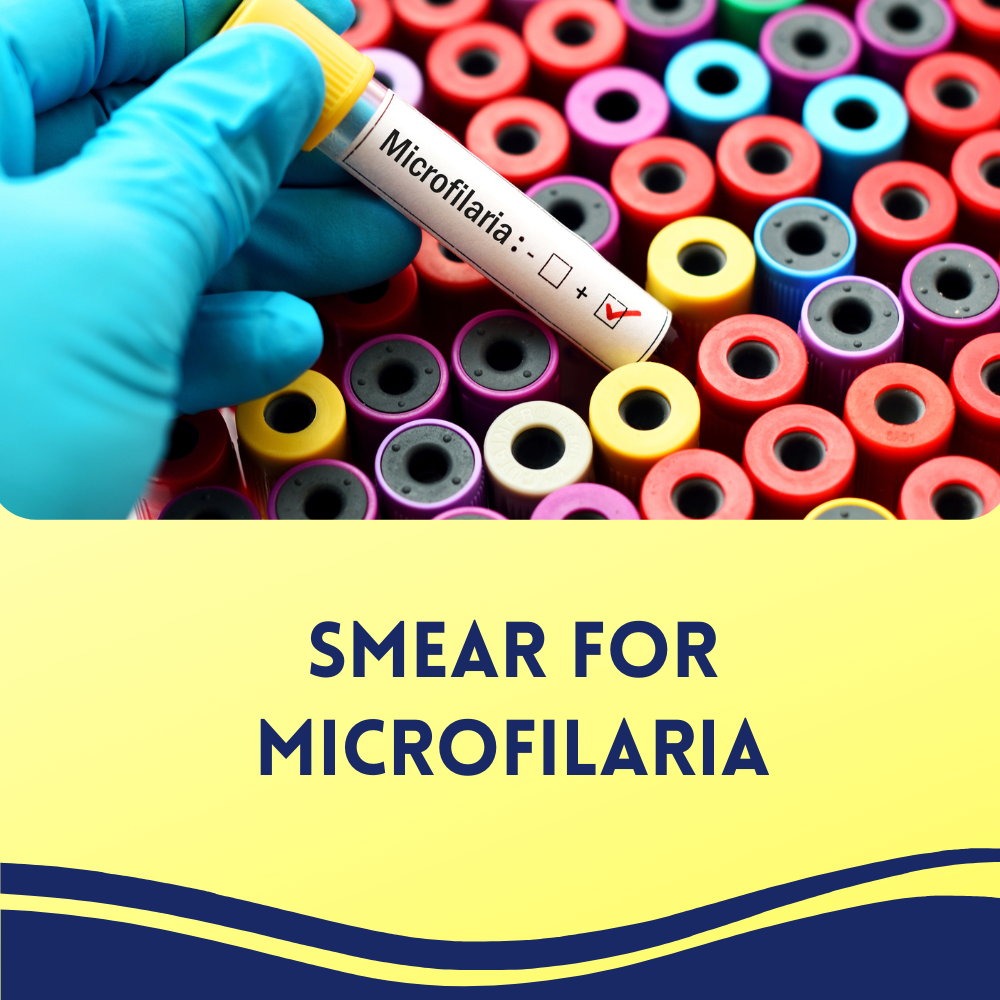 Smear for Microfilaria