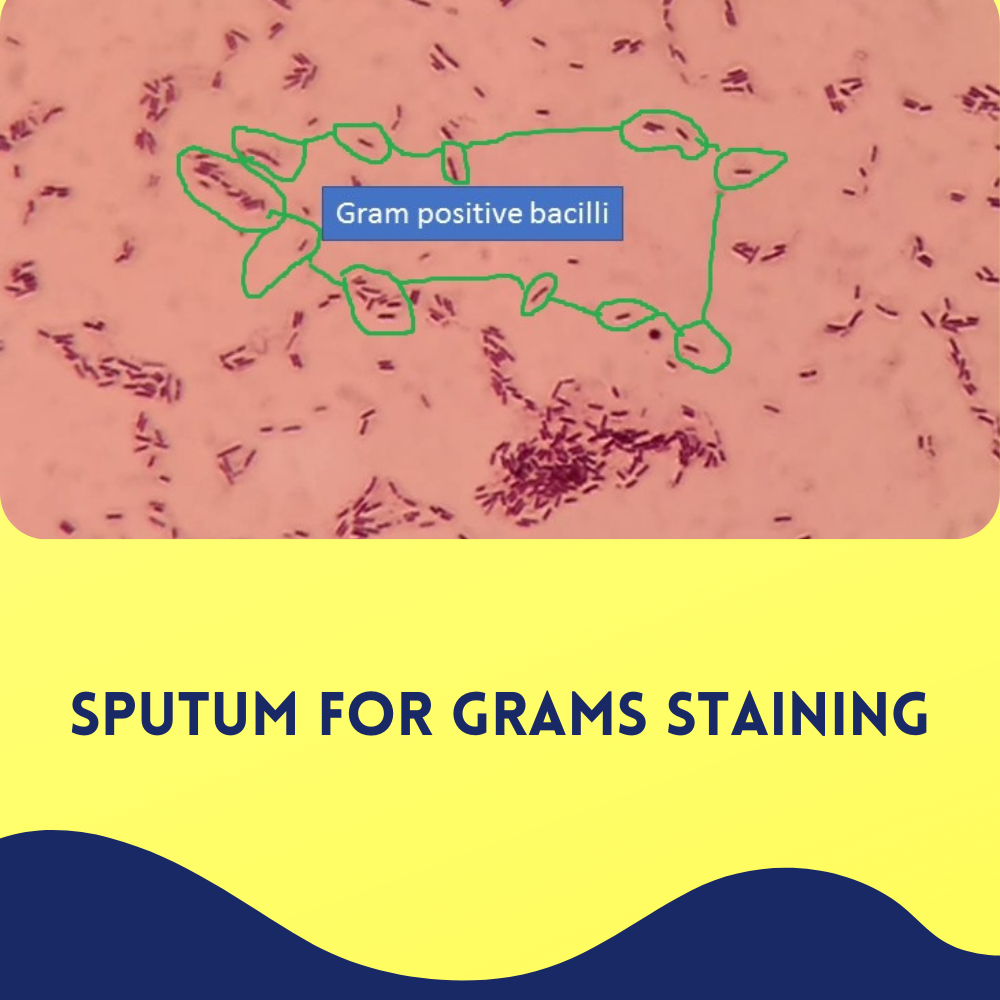 Sputum for Grams staining