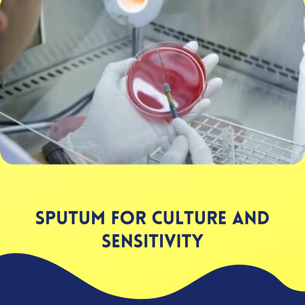 Sputum for culture and sensitivity
