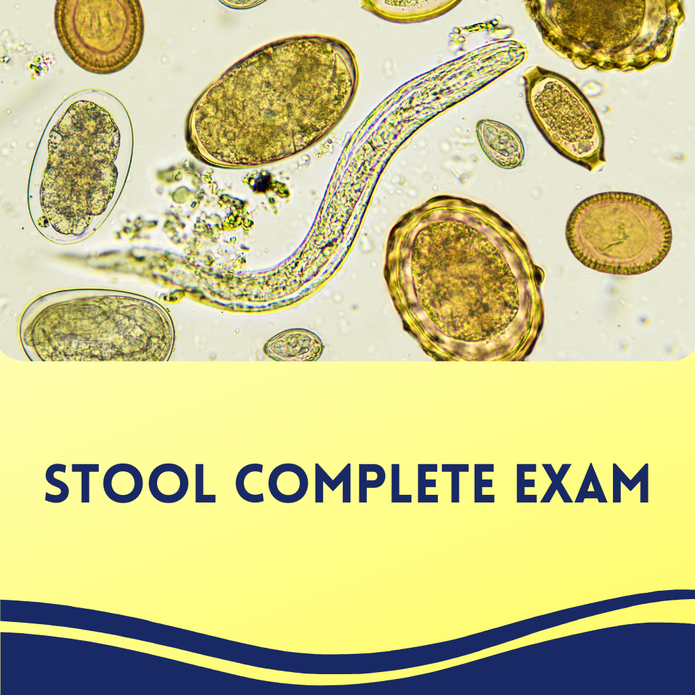 Stool Complete Exam