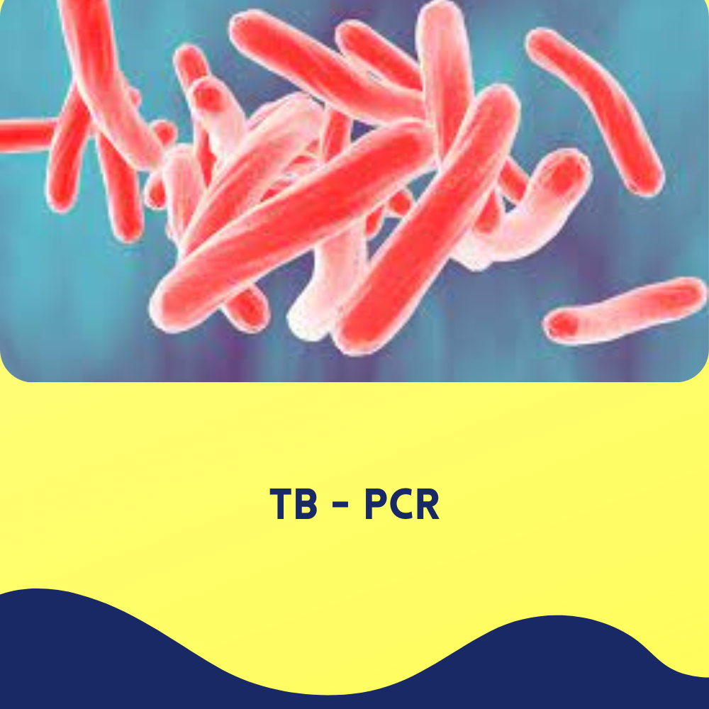 TB - PCR