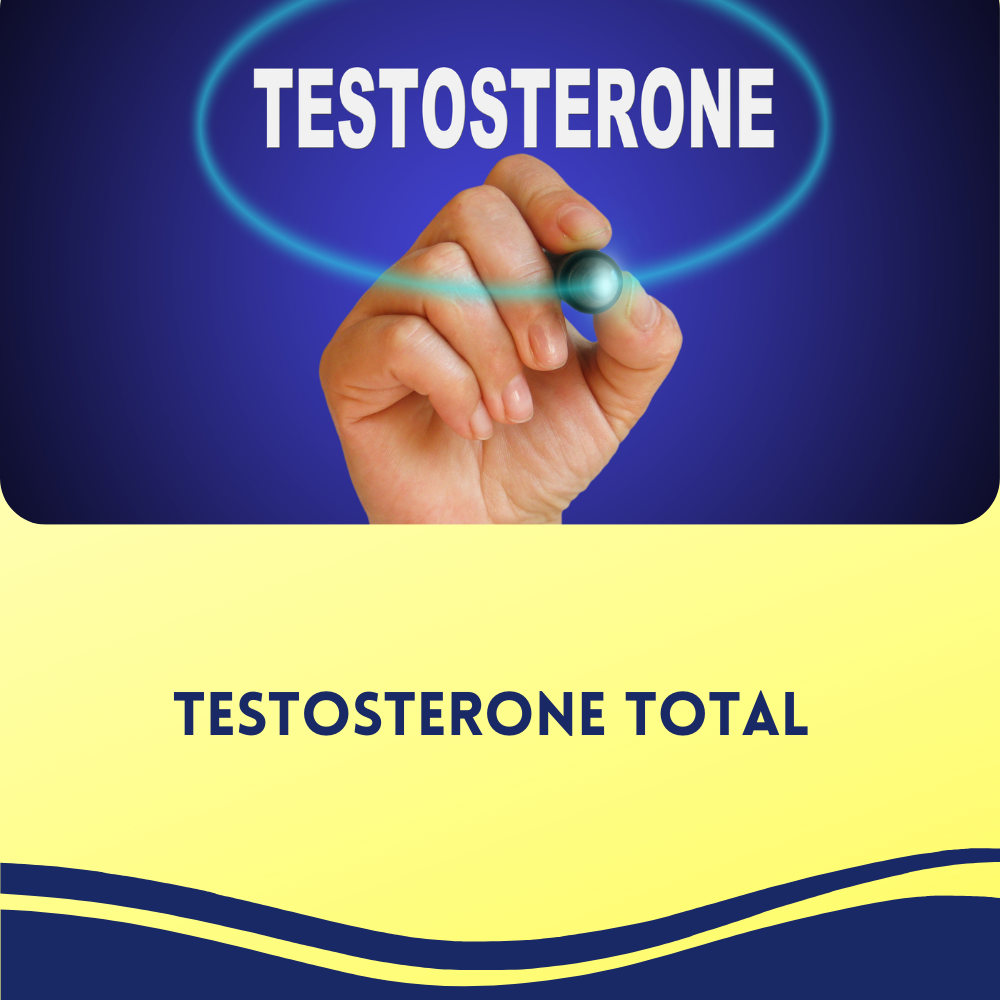 Testosterone Total
