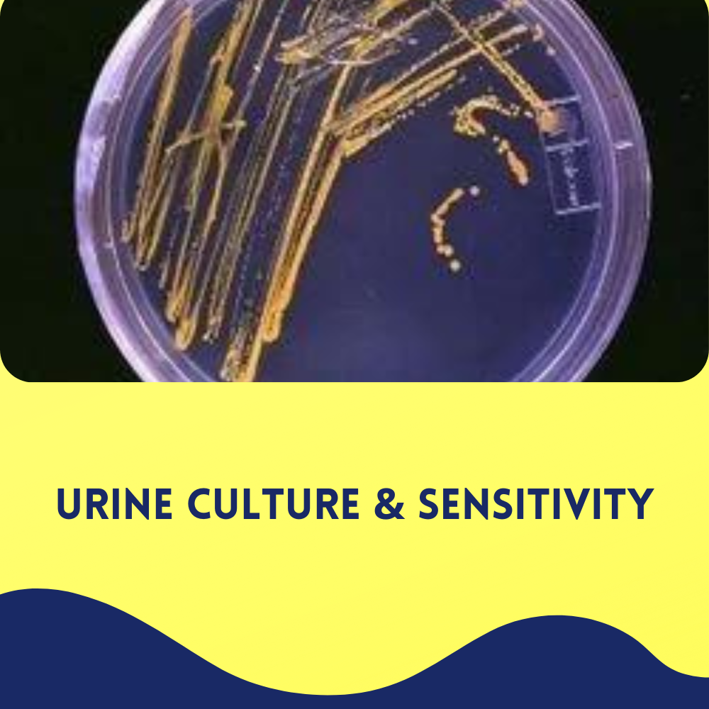 Urine Culture & sensitivity